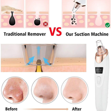 ClearSkin™ Poriënreiniger | Verwijder mee-eters en reinig je huid tot diep in de poriën
