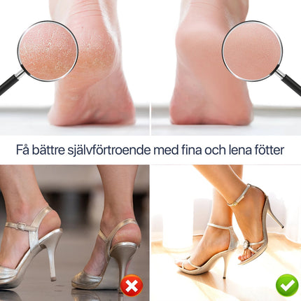 SmoothFeet™ Elektrische Voetvijl | Verwijder eelt snel en geniet van zijdezachte voeten