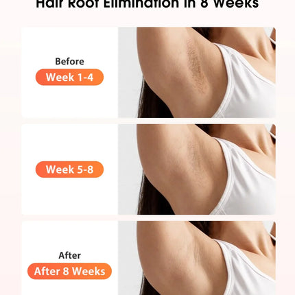 SmoothMen™ IPL Ontharingsapparaat | Pijnloos en langdurig ontharen voor mannen